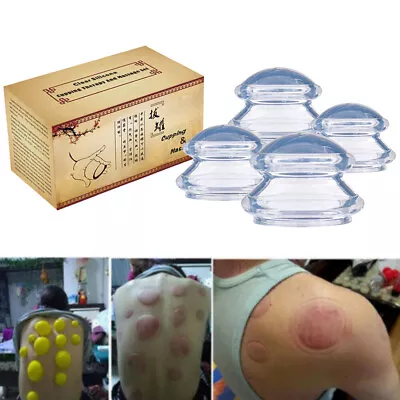 4 Cups Cupping Set Vacuum Suction Chinese Massage Medical Body Health Therapy US • $15.89