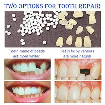 Instant Smile Teeth Covers Whitening Veneers Temporary Repair Gap Cover Ultra • £4.32