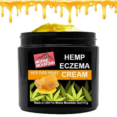 - PSORIASIS/ ECZEMA	SOOTHING PURE HONEY CREAM Rosacea Dermatitis And Shingles  • $21.67