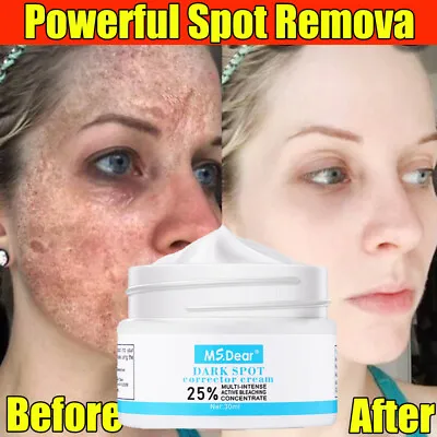 Strong Removal Melasma Whitening Cream Freckle Speckle Sunburn Spots Pigment USA • $8.62