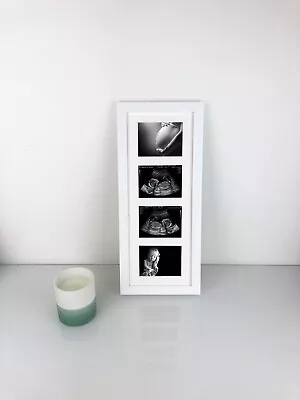 Baby Scan Frame Holds 4 Photos Or Ultrasound Sonogram 12 & 20 Week Scan Prints • £18.95