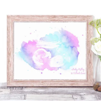 Personalised Baby SCAN Ultrasound Picture Print Watercolour Style Word Art • £5.35