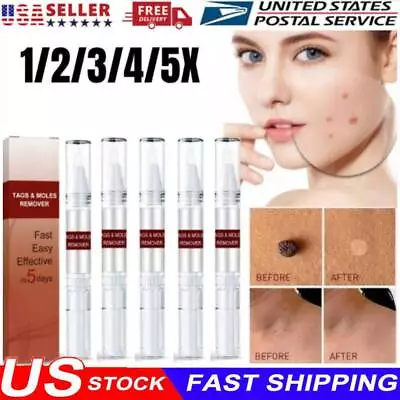 1-5x Skin Tags & Moles Removal Quick Safe Remover Restore Skin • $2.99