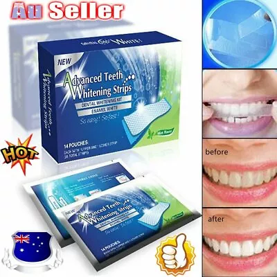 $10.15 • Buy 14 Professional Advanced Teeth Whitening Strips Tooth Bleaching White Strip ZR