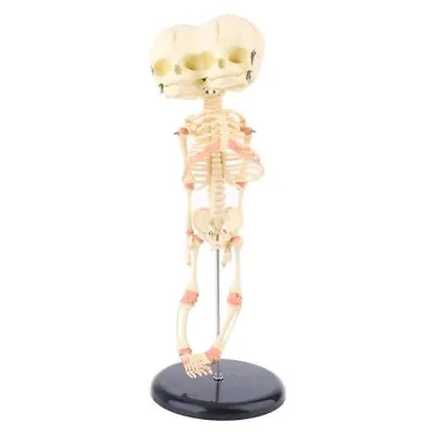 Human Baby Deformed For Head Skull Research Model Skeleton Anatomical Brain Anat • £34.03