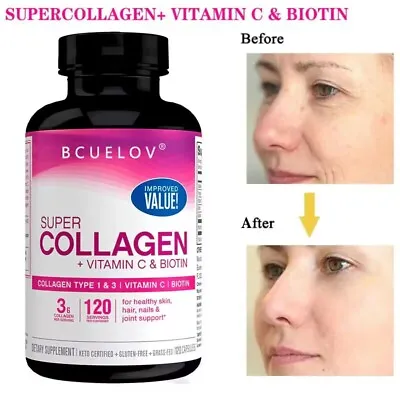 Super Collagen + Vitamin C With Biotin - Youthful Skin 120 Capsules • £8.99