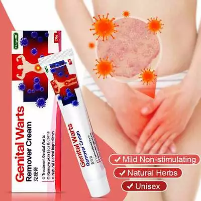 UK Genital Herpes Wart Remover Ointment Skin Tag Mole Acuminatum Treatment Cream • £8.18