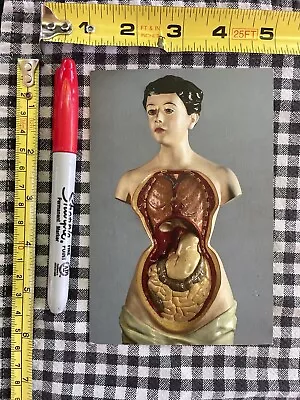 Effects Of Corsetry Medical Postcard Sculpture Photo Doctor Office Gothic Artist • $2.99