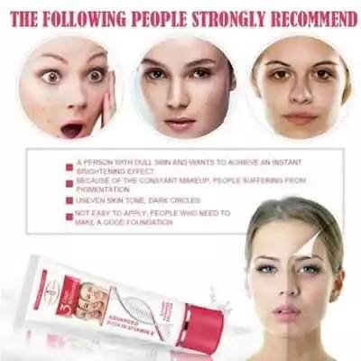 Skin Whitening Cream Face Brightening Dark Spot Removal Body Bleaching Lotion • £4.99