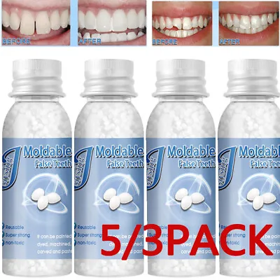5/3x Tooth Repair Granules Temporary Reusable Moldable False Teeth Fitting Beads • $8.78