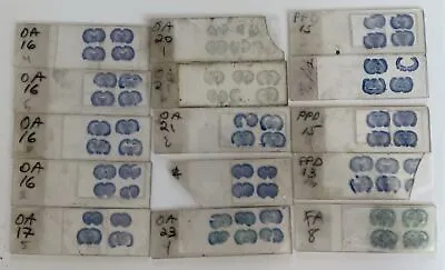 15 Vintage Neuroanatomy  Microscope Slides Marked OA PPD And FA • $42