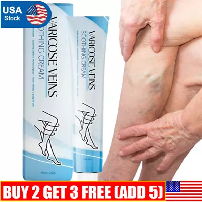 Raura Varicose Veins Cream Raura Varicose Veins Treatment Cream For Legs USA • $9.99
