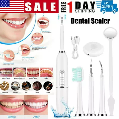 $14.35 • Buy Electric Ultrasonic Dental Scaler Tooth Cleaner Calculus Stain Remover Oral Care