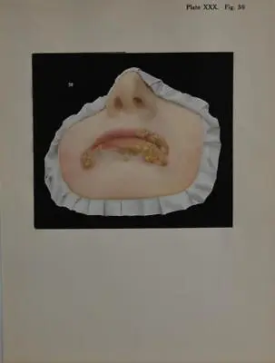 Anatomy Art Print Medical Human Face Mouth Halloween Antique Original 1914 • $19.99