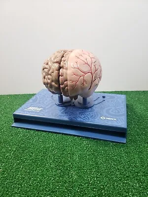 Merck Maxalt Brain Model  An Inside Look At Migraine  Migraine Headache Display • $49.95