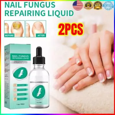 Kerassentials For Toenail Fungus Kerassentials Toenail Fungus Treatment Oil New • $10.89