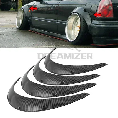 For Honda Civic Carbon Fiber Fender Flares Flexible Wide Body Kit Wheel Arches • $99.01