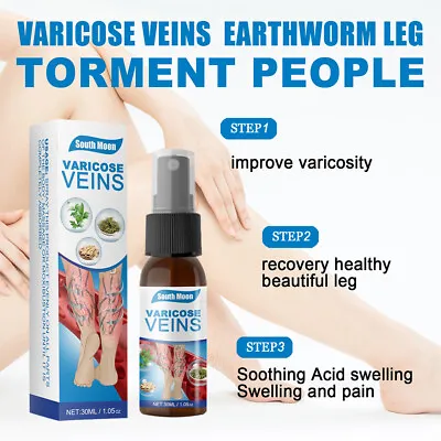 Varicose Veins Miracle Ointment Cream Gel Veinhealing Varicose Treatment Spray • £6.95