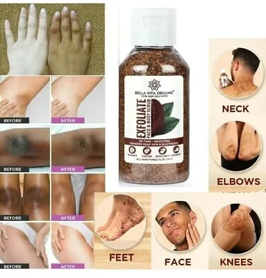 Coffee Scrub For Face Body Neck Knees Blackhead Remover Tan Dirt Removal 75 Gm • $45.14