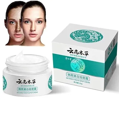 Whitening Spot Lightening Cream Japanese Melasma Cream Yunnan Herbal Cream • $9.85