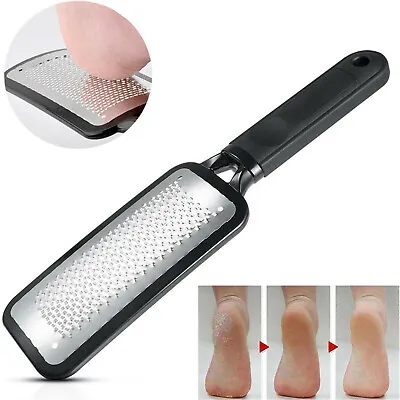 Professional Foot Rasp File Pedicure Callus Remover Hard Dead Skin Scrubber • £2.95