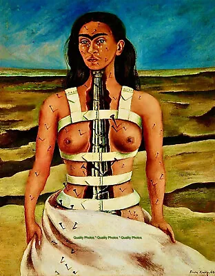 The Broken Column 8.5x11  Photo Print Frida Kahlo Self-Portrait Broken Back Art • $8.67