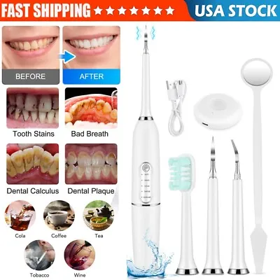 $12.95 • Buy Electric Ultrasonic Dental Scaler Tooth Cleaner Calculus Remover Teeth Whitening