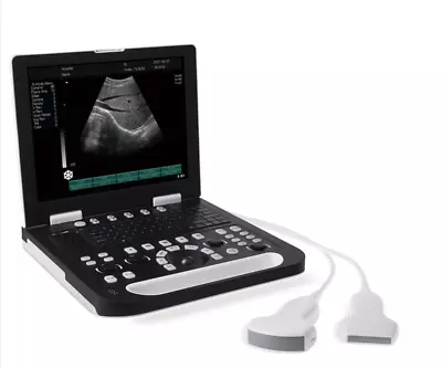 15  Full Digital Laptop Vet LCD Screen Medical Ultrasound  Dual Channel Probe • $2684.99