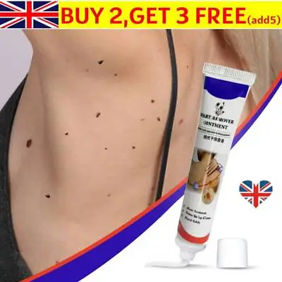 Wart Ointment Genital Herpes Skin Remover Antibacterial Treatment ❤️ • £5.63