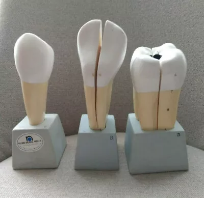 Lot Of 3 Vintage Nystrom Biological Model Co. Dental Teeth Models • $220.95