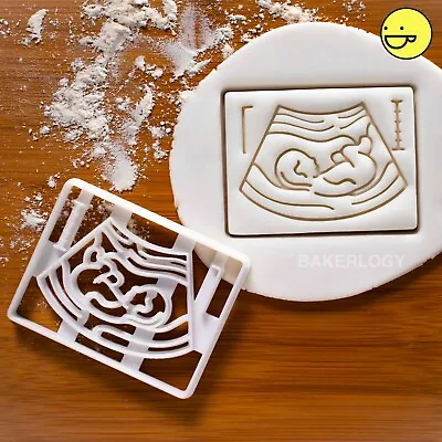 Pregnancy Ultrasound Scan Cookie Cutter | Announcement Birth Baby Party Pregnant • £12.51