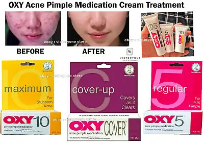 Treatment Face Acne Pimple Medication Cream OXY 5/10 Cover Up - Benzoyl Peroxide • $41.62