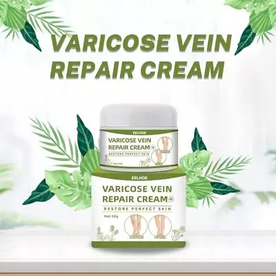 Treatment Legs Varicose Veins Cream Vein Care Fading Cream Herbal Ointment • £4.97