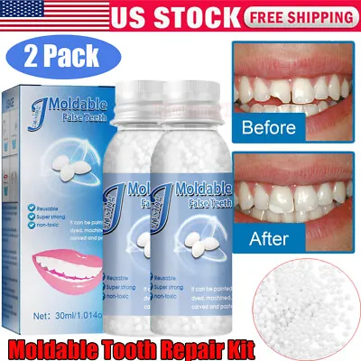 2PCS Tooth Repair Beads GranulesTemporary Moldable Dental Pellets False Teeth • $10.28