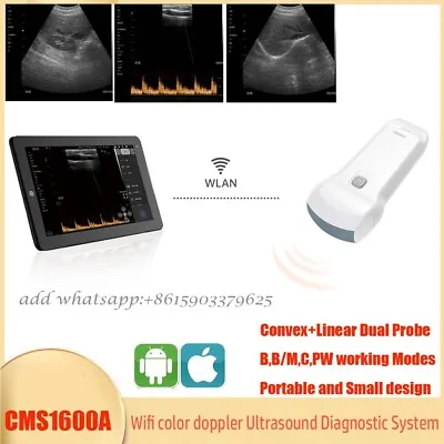 Medical Imaging Handheld Dual-probe Color Doppler Ultrasound Machine WIFI • $1800