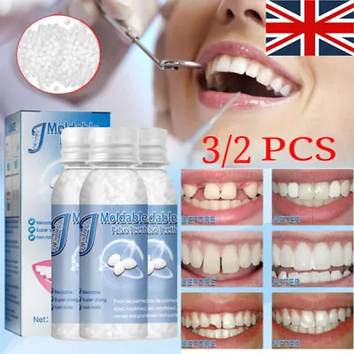 Temporary Tooth Repair Resin Fix Broken False Teeth Fill Gaps Dental Denture Kit • £7.95