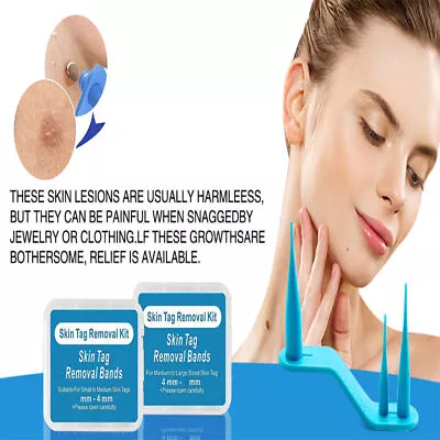 3 IN 1 Auto Micro Mole Remover Wart Remover Skin Tag Remover Wart Mole Vanish • $5.99