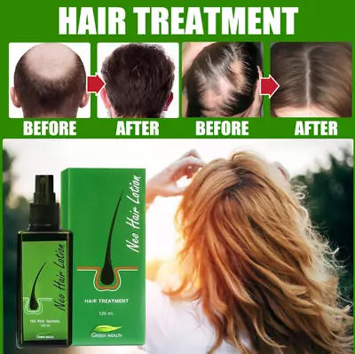120ml Neo Hair Lotion Root Treatment Original Nutrients Longer Hair Treatment • £6.89