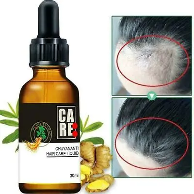 7 Days Hair Growth Products For Men Women Natural Oil Serum Grow Fast K9Q9 • $6.26