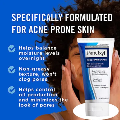 Acne Foaming Wash Face & Body 156g Peroxide All Skin Types 10% Active Ingredient • £7.98