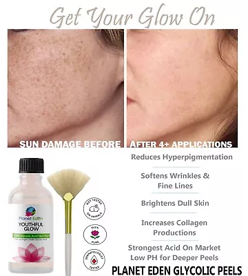 60% Glycolic Acid Skin Peel Kit + Glycolic Cleanser + Recovery Cream + BRUSH  • $27.50