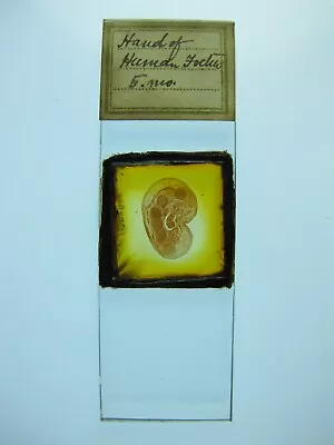 Antique Microscope Slide.  T.S. Hand Of A 5 Month Old Human Foetus . • $6.32