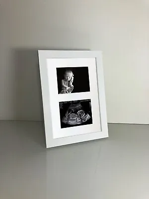 Double Baby Ultrasound Pregnancy Scan 1st Photo Twin Aperture White Frame • £11.95