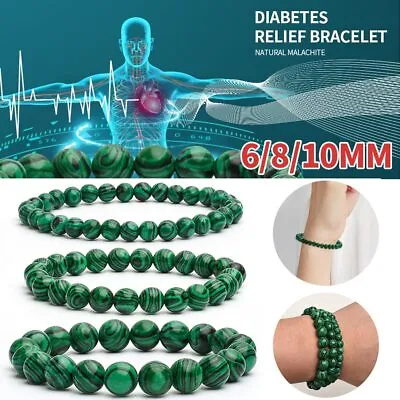 6/8/10MM Crystal Beads Diabetes Relief Bracelets Malachite Beaded Bracelets Gift • $6.25