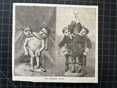 Vintage Etching - Siamese Twins Tocci Bros. - Circus Oddity Freak Sideshow • $30