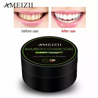 Activated Charcoal Teeth Whitening Powder - Natural Tooth Whitening Dental Care • £4.99