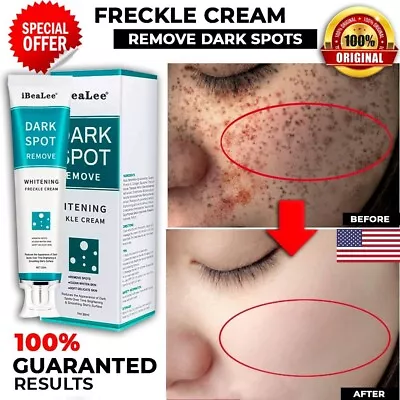 NEW Whitening Freckle Cream Face Moisturizing Remove Dark Spots Melanin Melasma✅ • $10.98