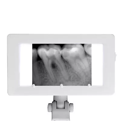 Dental X-Ray Film Viewer LED Illuminator View Box Light Panel For Dental Chair • $25.55