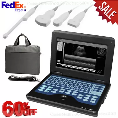 US FedexUltrasound Scanner Laptop Machine Convex Linear Cardiac Transvaginal  • $400