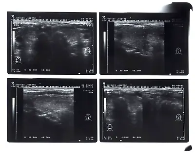 Genuine Vintage Hospital Human X-Ray Ultrasound Scan Original Acetate Film • £35